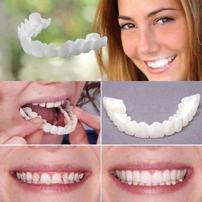snap-on smile fatete
